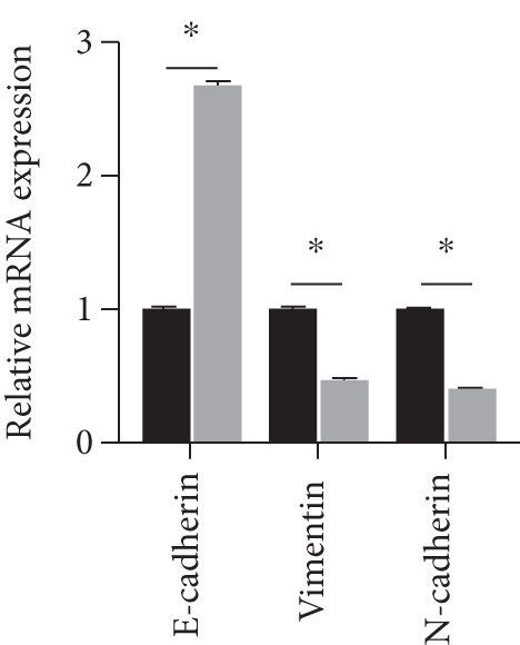 Knockdown Of Fgb Suppressed The Emt Progress Of Bc A Western Blot