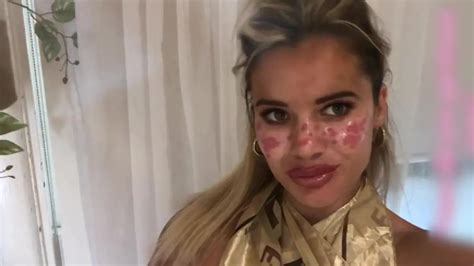 Bonnie Blue Sex Rekord Mit M Nnern Gleichzeitig Hat Folgen Erotikmodel Zeigt Verletzungen