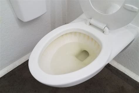 How To Remove Yellow Stains From Toilet Seat Cover Velcromag