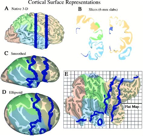 Functional and structural mapping of human cerebral cortex: Solutions ...
