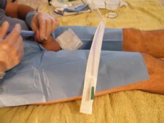 CORRECT CATHETER INSERTION PROCEDURE Pornhub Gay
