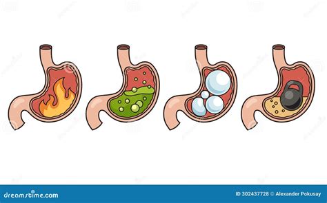 Stomach Disease Structure Diagram Medical Science Vector Illustration