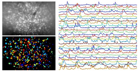 Lightweight Miniscope Lights Up Mouse Brains Around The Globe