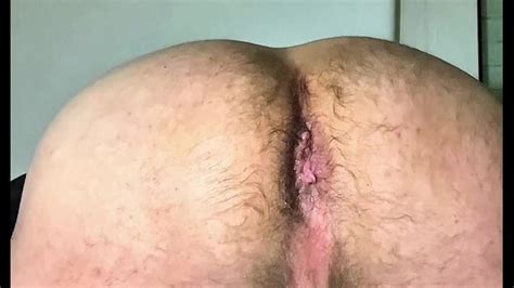Problema Di Apertura Del Culo Pornhub Gay