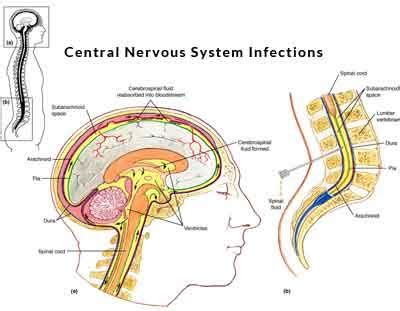 Antibiotic Guideline For Central Nervous System Infections