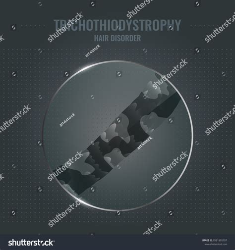 1 Trichothiodystrophy Images, Stock Photos & Vectors | Shutterstock