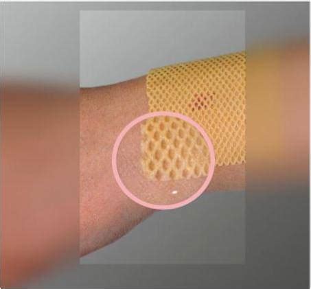 повязки на рану