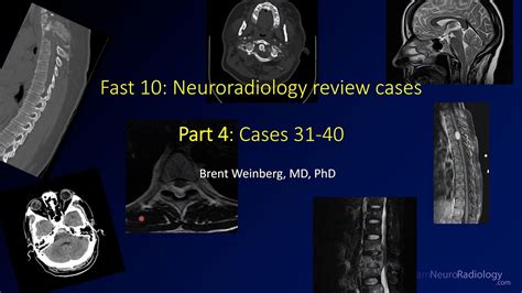 Fast 10 Neuroradiology High Speed Case Review Part 4 Cases 31 40