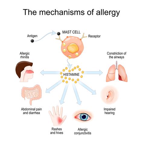 Cosa sono e come funzionano le allergie stagionali