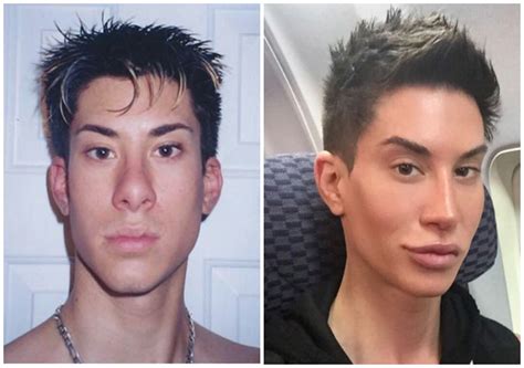 Justin Jedlica Voor En Na Justin Jedlica: Striving For Perfection