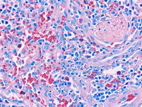 giemsa control histology