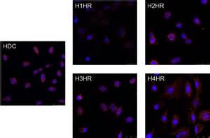 In Vitro Expression Of Histidine Decarboxylase And Histamine Receptors