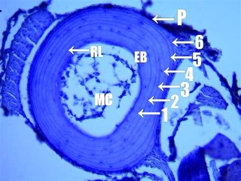 A cross section μm thick of a phalange of a sex year old male