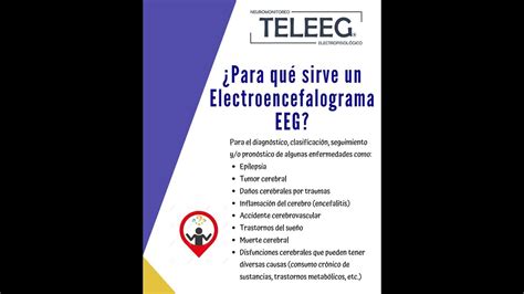 En Qu Consiste Un Electroencefalograma Youtube