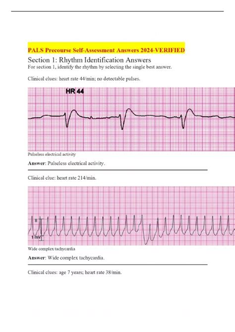 PALS Precourse Self-Assessment Answers 2024-VERIFIED - Top-Rated 2024/