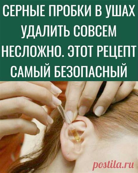 СЕРНЫЕ ПРОБКИ В УШАХ УДАЛИТЬ СОВСЕМ НЕСЛОЖНО. ЭТОТ РЕЦЕПТ САМЫЙ БЕЗОП ...