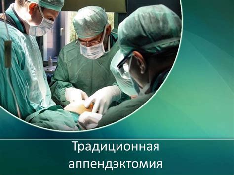 Аппендектомия. Способы аппендэктомии - презентация онлайн