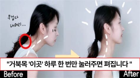 목부위 이곳만 눌러주세요 거북목 바로 잡고 두통도 사라지는 목 어깨 끝판왕 마사지 방법