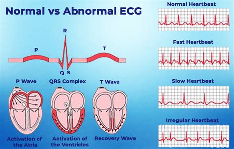 Normal Echocardiogram