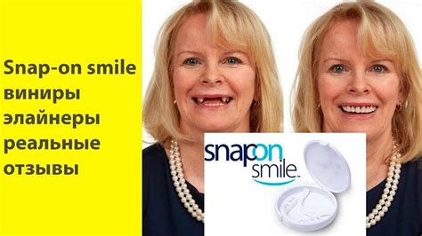 Накладные виниры на зубы цена в москве - YouTube