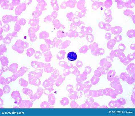 Human Blood Smear Lymphocyte Stock Photo Image Of Haematology