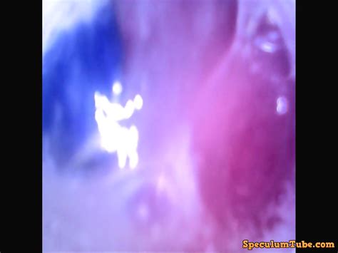 Pool Balls In My Ass