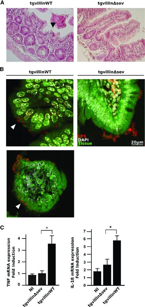 The Severing Activity Of Villin Is Required For Salmonella Infection In