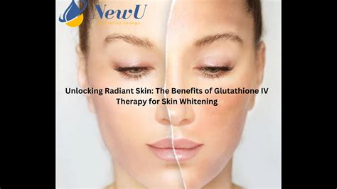 Glutathione Iv Therapy For Skin Whitening Near Me Newuhydration