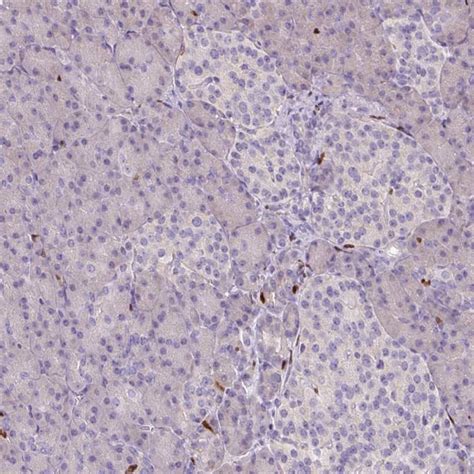 PU.1 Antibody (PA5-83731)