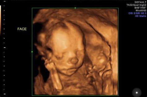 The Most Important Reason I Wanted To Find Out My Baby S Sex