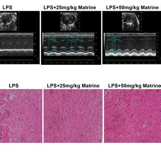 Matrine Improves Cardiac Function In Mice A Representative Images Of