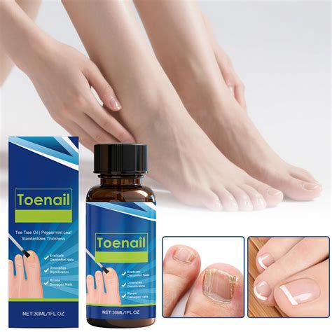 Nail Strengthening Care Liquid for Onychomycosis and Ingrown Nails