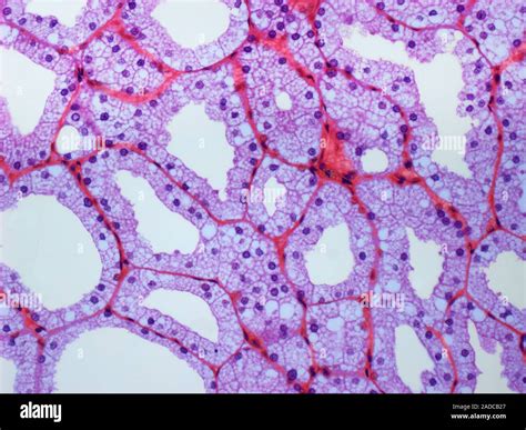 Lachrymal gland. Light micrograph of a section through the lachrymal ...