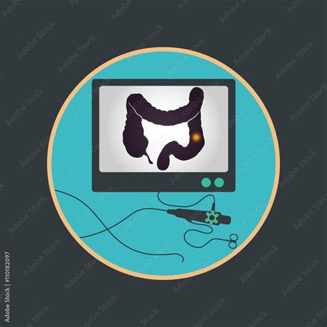 Colonoscopy procedure used for screening colon diseases Stock Vector | Adobe Stock