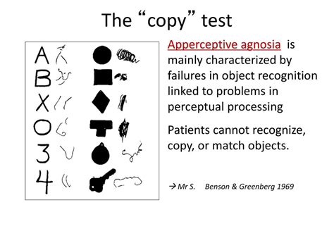 Visual Agnosia