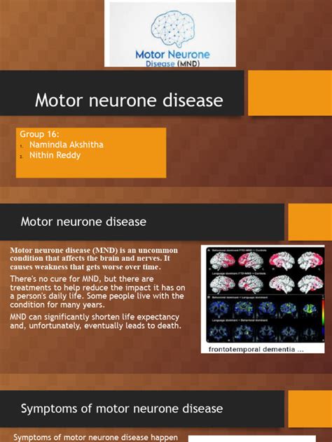 Motor Neurone Disease | PDF | Human Diseases And Disorders ...