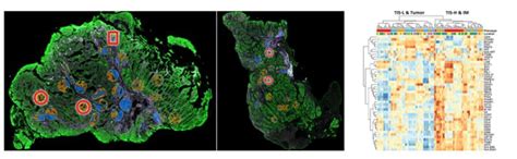 Illumina Nanostring Geomx Digital Spatial Profiling With Dragen