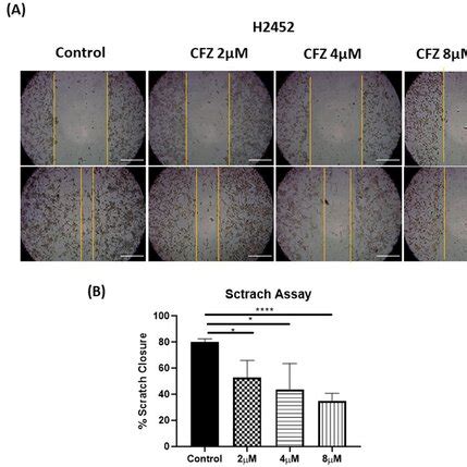 Scratch Assay In Vitro Scratch Wound Healing Assay With H Cells