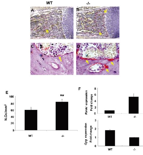 Activity Of Osteoclasts Is Increased In Gpr48 Mice As Assessed By