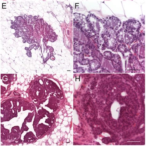 Incidence Of Mammary Gland Tumors Developing In Wistar Furth Female