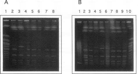 Pulsed Field Electrophoretic Separation Of Fragments Generated By SwaI