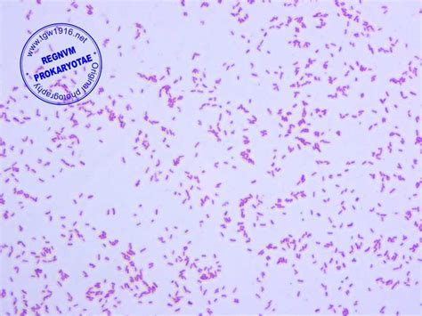 The Role of Citrobacter freundii Biochemical Tests in Identifying and ...