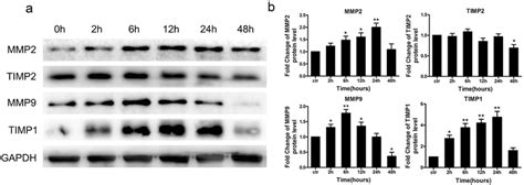 Expression Of MMP2 MMP9 TIMP1 And TIMP2 Of HUASMCs Treated With