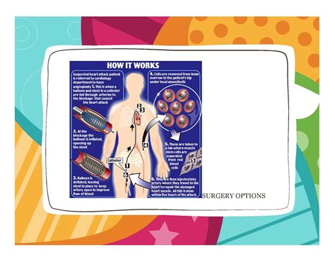 CVD - surgery options