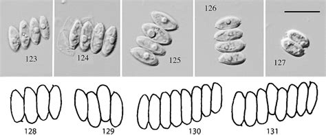 1 Desmodesmus Itacaensis Under The Light Microscope Scale Bar