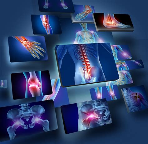 What Is Rheumatoid Arthritis Biokineticist Andries Lodder Bio4me