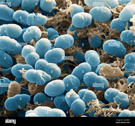 Staphylococcus Epidermidis Bacteria Coloured Scanning Electron Micrograph Sem Of Clusters Of