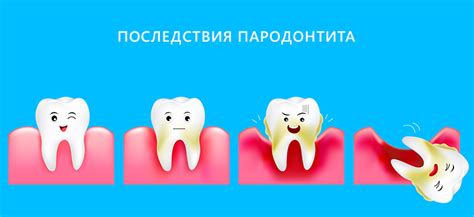 Лечение пародонтита в Москве, цены на лечение пародонтита