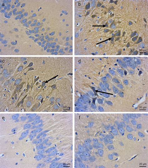 Photomicrographs of histological sections of the CA3 region of ... 