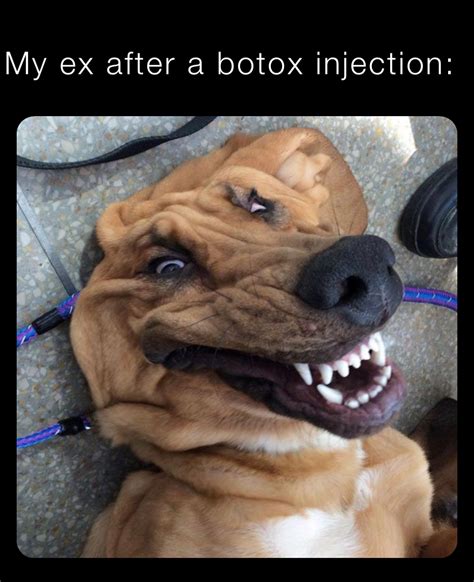 My ex after a botox injection: | @Vychod_radek | Memes